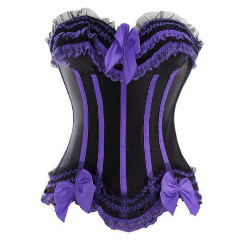 Classic Fashion Trim Pattern Bow Lace Overbust Corset